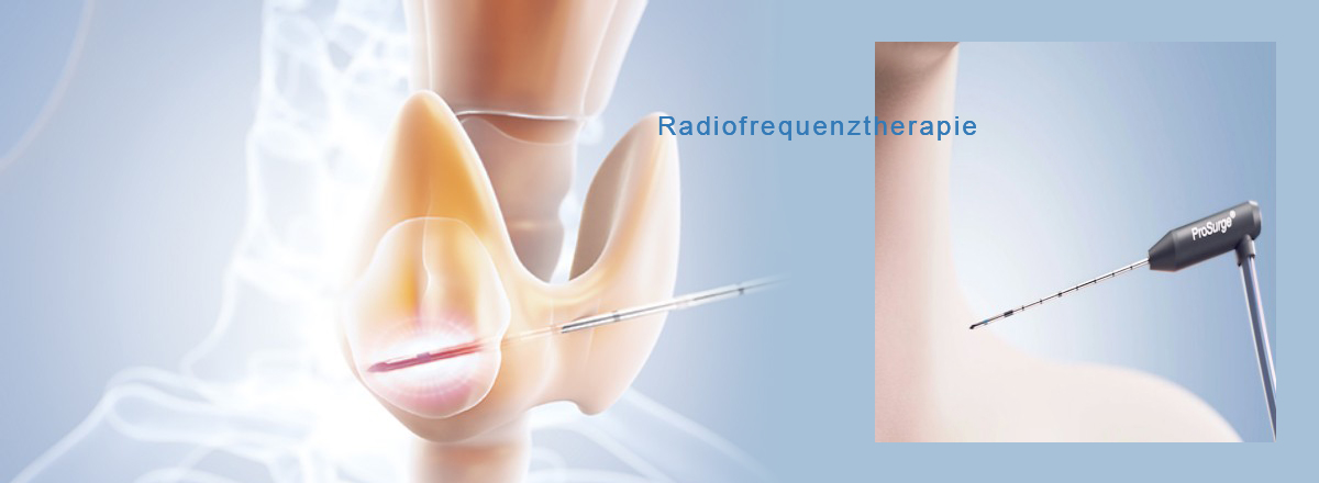 Medicum, Radiofrequenztherapie