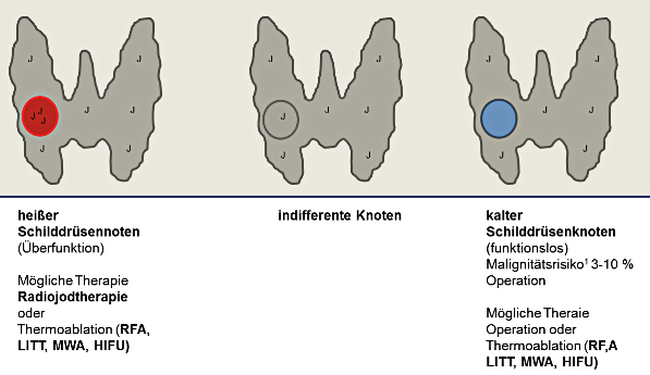 Knoten